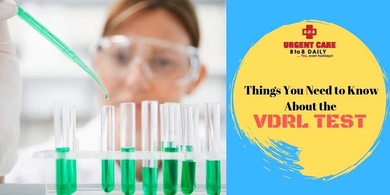 Things You Need to Know About the VDRL Test