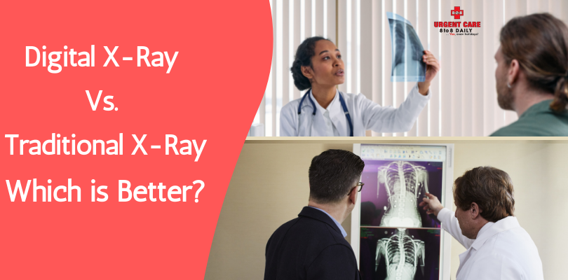 Digital X-Ray Vs. Traditional X-Ray: Which is Better?