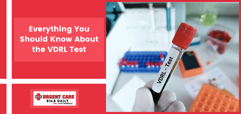 VDRL Test in Oceanside, CA | All You Need to Know