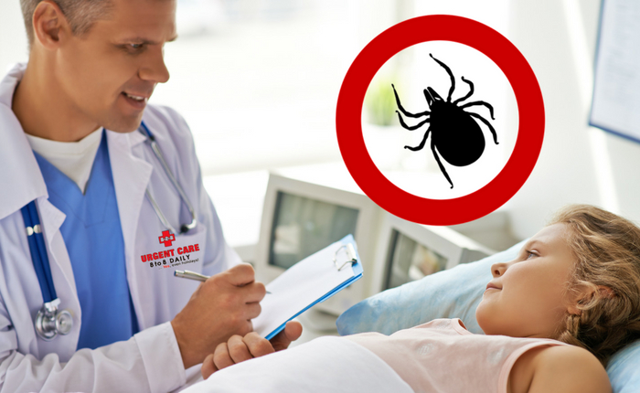 7 Tick-Borne Illnesses You Need to be Aware of
